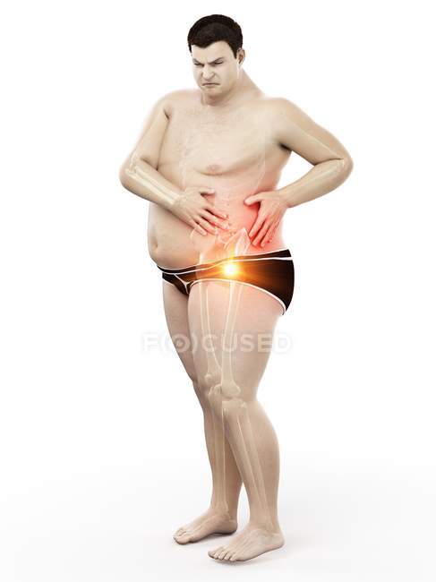 Silueta de hombre obeso con dolor de cadera, ilustración digital . - foto de stock