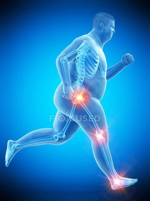 Силует бігу людини з болем в суглобах, комп'ютерна ілюстрація . — стокове фото