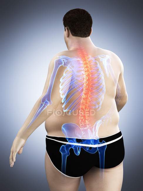 Cuerpo masculino obeso con dolor de espalda, ilustración digital
. — Stock Photo