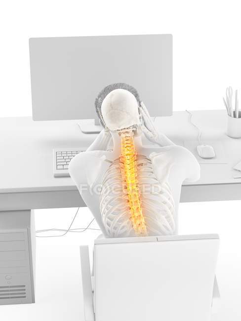 Стрессовый офисный работник с болью в спине на заднем плане, концептуальная иллюстрация . — стоковое фото