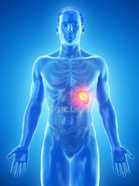 Рак селезенки в мужском теле, концептуальная компьютерная иллюстрация
. — стоковое фото