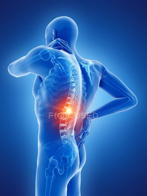 Corpo maschile con mal di schiena su sfondo blu, illustrazione digitale . — Foto stock
