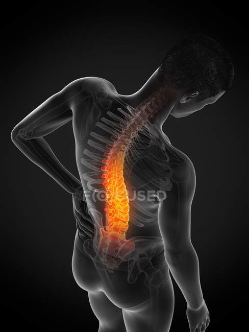 Мужской силуэт с болью в спине под высоким углом обзора, концептуальная иллюстрация . — стоковое фото