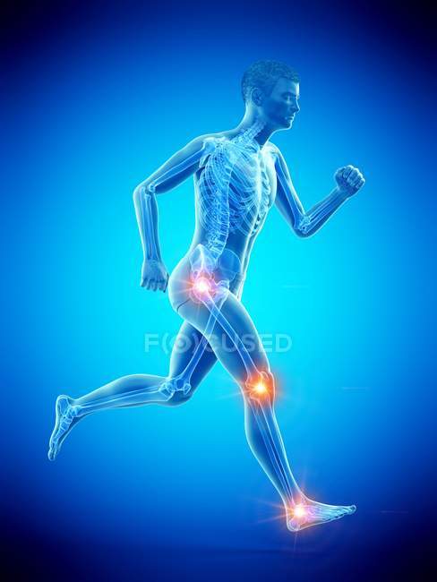Hombre corriendo con puntos de dolor articular, ilustración conceptual . - foto de stock