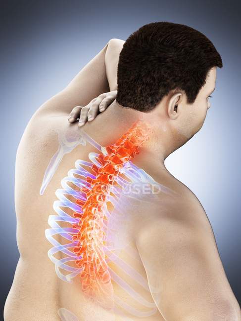 Close-up de sobrepeso masculino com dor nas costas, ilustração conceitual . — Fotografia de Stock