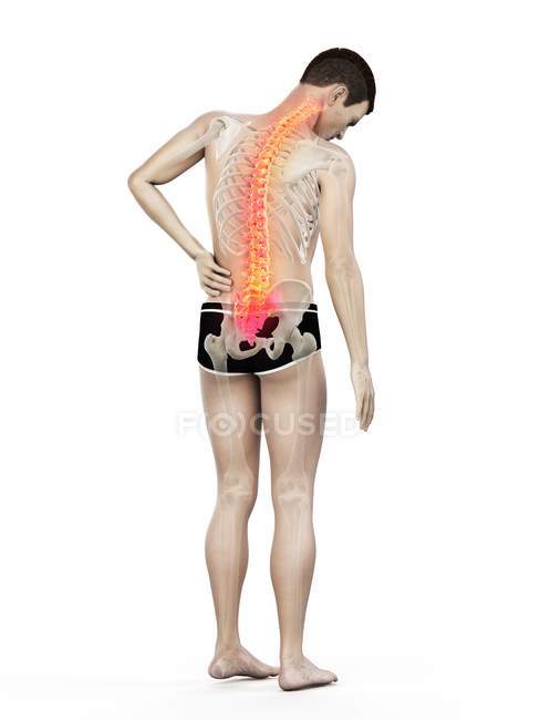 Vista trasera del cuerpo masculino con dolor de espalda, ilustración conceptual
. - foto de stock