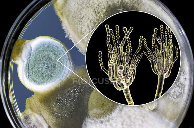 Colonias de hongos Penicillium cultivados en Sabouraud Dextrosa Agar e ilustración digital de la morfología fúngica . - foto de stock