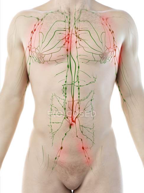Ganglios linfáticos agrandados en el cuerpo masculino, ilustración conceptual por computadora
. - foto de stock