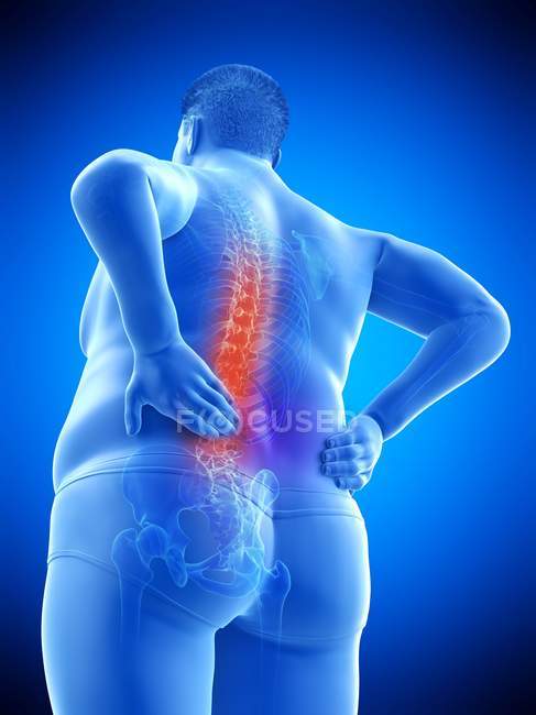 Obese male body with back pain in low angle view, digital illustration. — Stock Photo