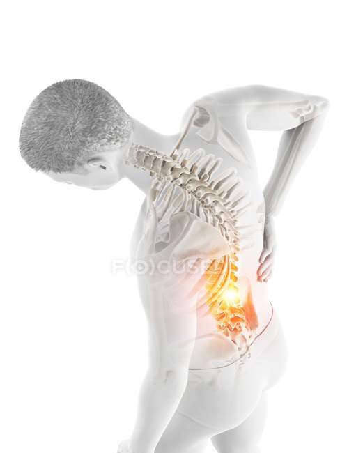 Vista de ángulo alto del cuerpo masculino de flexión con dolor de espalda, ilustración conceptual . - foto de stock