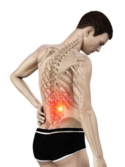 Silueta masculina con dolor de espalda sobre fondo blanco, ilustración conceptual . - foto de stock