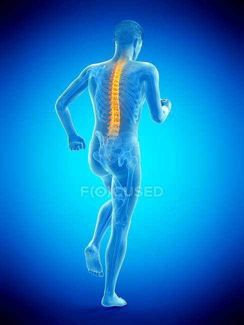 Running male silhouette with back pain, conceptual illustration. — Stock Photo