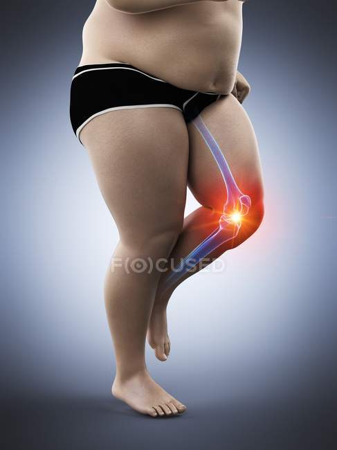 Силует чоловічого бігуна з болем у коліні, концептуальна цифрова ілюстрація . — стокове фото