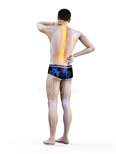 Visão traseira do corpo masculino com dor nas costas, ilustração conceitual
. — Fotografia de Stock