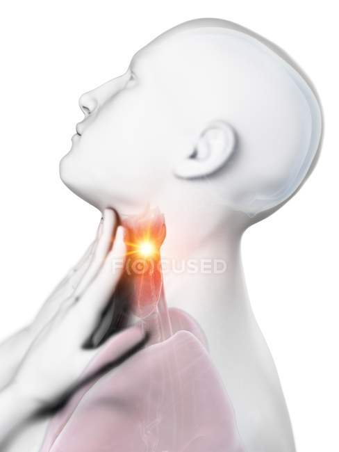 Corpo masculino abstrato com dor de garganta em fundo branco, ilustração digital conceitual . — Fotografia de Stock