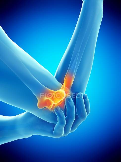 Close-up of human body with elbow pain, digital illustration. — Stock Photo