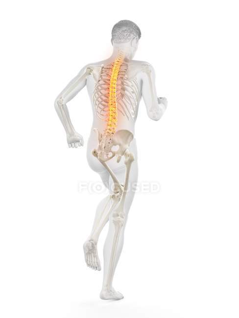 Correndo silhueta masculina com dor nas costas, ilustração conceitual . — Fotografia de Stock