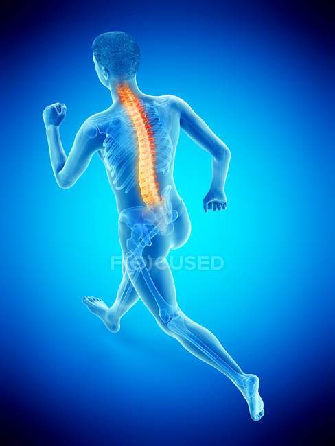 Silhouette dell'atleta di corsa con mal di schiena, illustrazione concettuale . — Foto stock