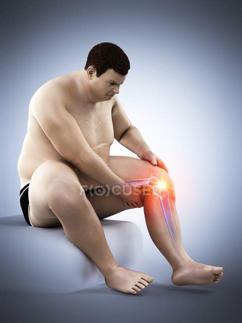 Силуэт сидящего толстяка с болью в колене, компьютерная иллюстрация . — стоковое фото