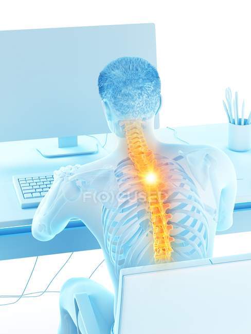 Vista trasera del trabajo en el escritorio silueta masculina con dolor de espalda, ilustración conceptual
. — Stock Photo