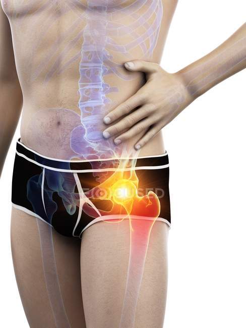 Silueta corporal masculina con dolor de cadera visible, ilustración digital
. - foto de stock