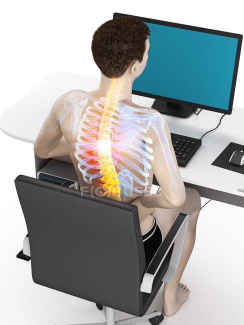 Trabalhador de escritório com dor nas costas em visão de alto ângulo, ilustração conceitual
. — Fotografia de Stock