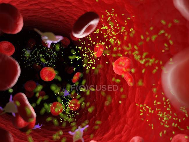 Бактерії серед кров'яних клітин у кровоносних судинах, цифрова ілюстрація . — стокове фото