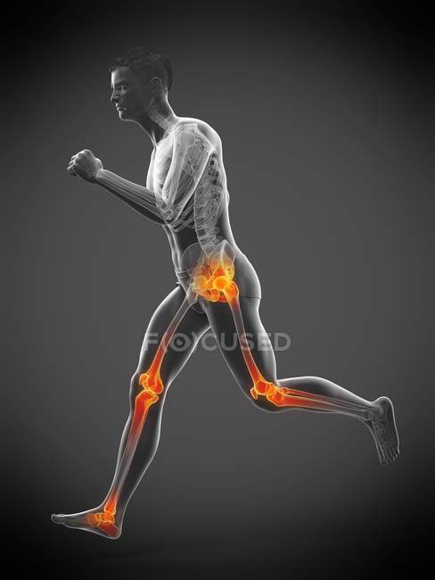 Запуск людини з точками болю в суглобах, концептуальна ілюстрація . — стокове фото