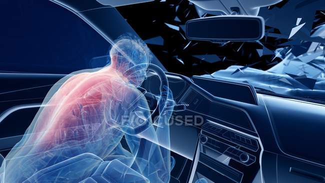 Illustrazione a raggi X del rischio di lesioni alla colonna vertebrale durante un incidente d'auto frontale, opere d'arte digitali . — Foto stock