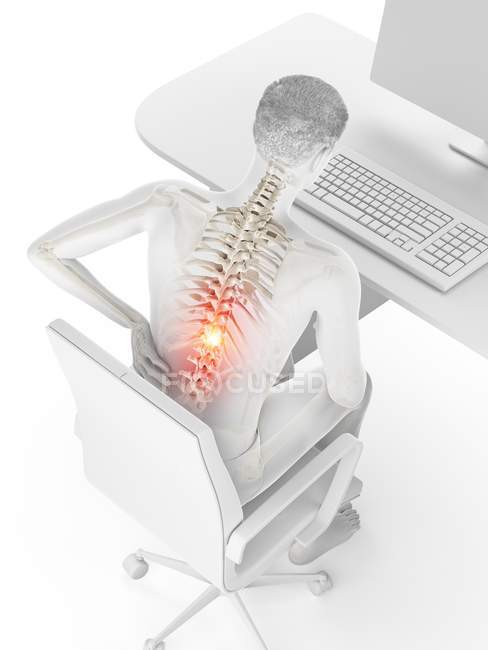 Travailleur de bureau avec mal de dos dû à assis en vue grand angle, illustration numérique . — Photo de stock
