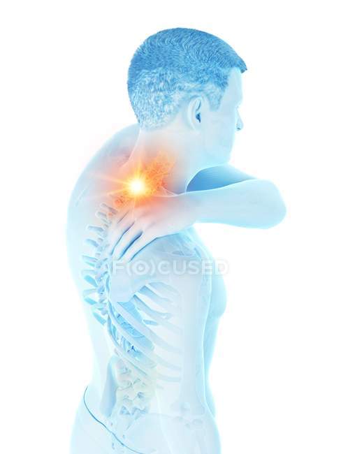 Silhueta do homem com dor no pescoço, ilustração conceitual . — Fotografia de Stock