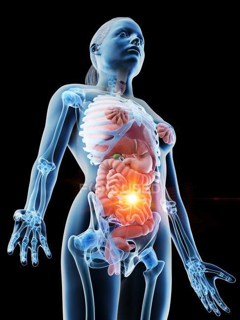Абстрактный женский силуэт с болью в животе, концептуальная цифровая иллюстрация . — стоковое фото