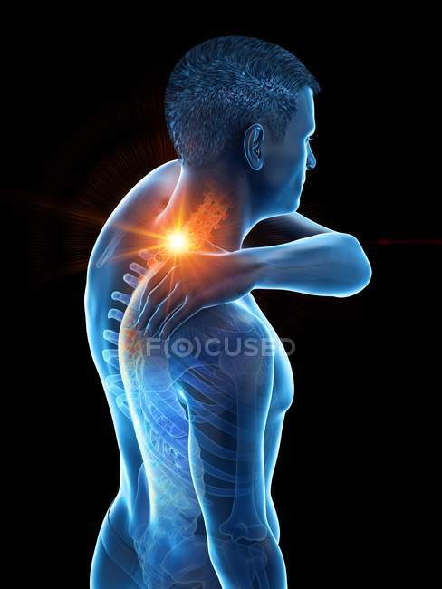 Silhouette of man having neck pain, conceptual illustration. — Stock Photo