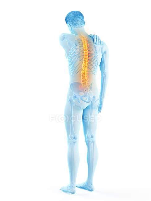Vue arrière du corps masculin avec maux de dos, illustration conceptuelle . — Photo de stock