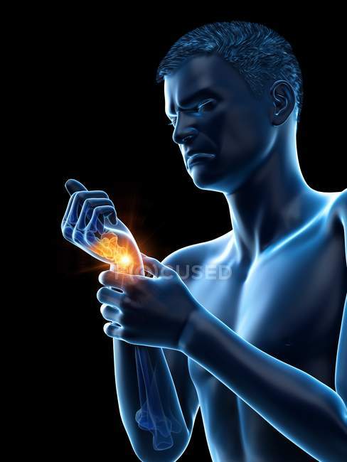 Corpo astratto dell'uomo con dolore al polso, illustrazione concettuale . — Foto stock