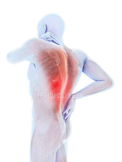 Silhouette del corpo maschile con mal di schiena, illustrazione digitale . — Foto stock
