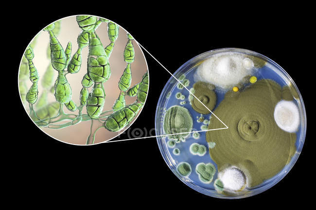 Illustrazione digitale della morfologia fungina del fungo allergenico filamentoso Alternaria alternata e fotografia di colonie fungine su Sabouraud Destrosio Agar . — Foto stock