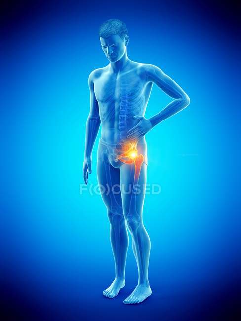 Silhouette de l'homme souffrant de douleur à la hanche, illustration numérique . — Photo de stock