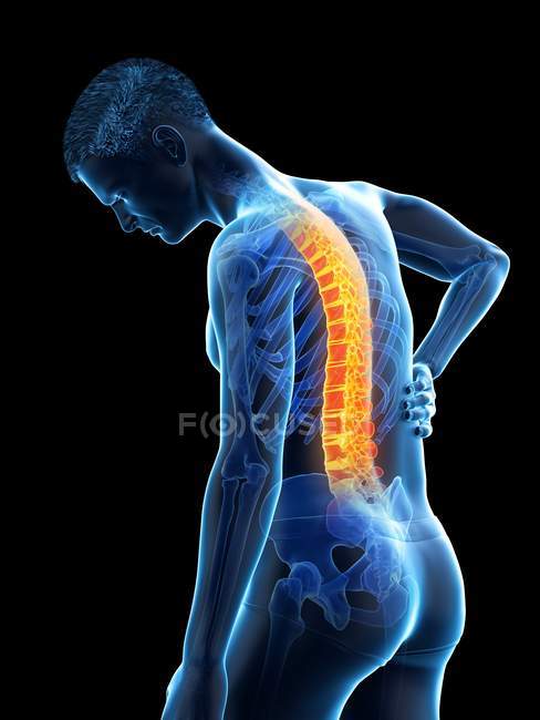 Silhueta masculina de flexão com dor nas costas, ilustração conceitual . — Fotografia de Stock
