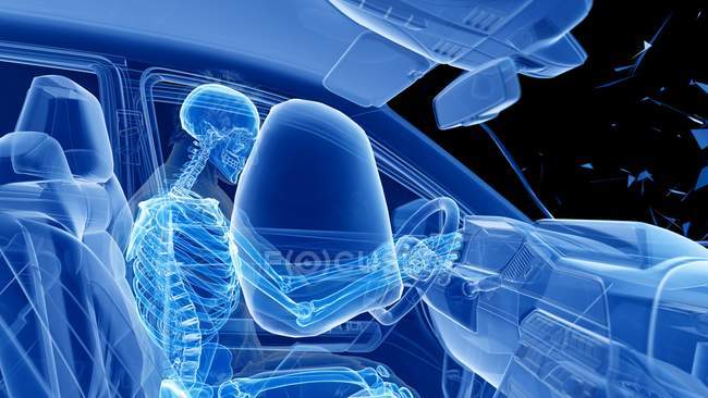 X-ray illustration of risk of injury while head-on car crash, digital artwork. — Stock Photo
