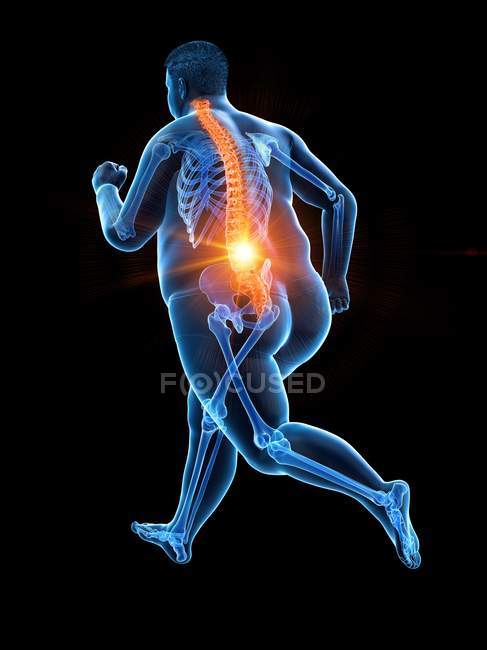 Obeso corpo corredor masculino com dor nas costas, ilustração conceitual . — Fotografia de Stock