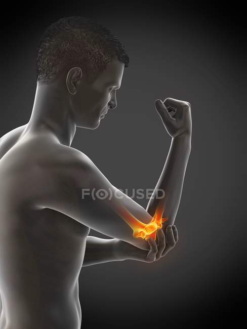 Corpo masculino abstrato com dor visível no cotovelo, ilustração conceitual
. — Fotografia de Stock