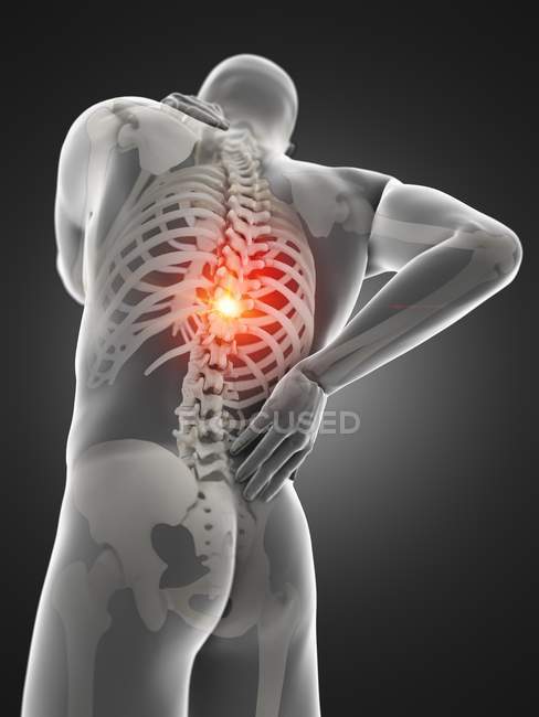 Silueta de cuerpo masculino con dolor de espalda, ilustración digital . - foto de stock