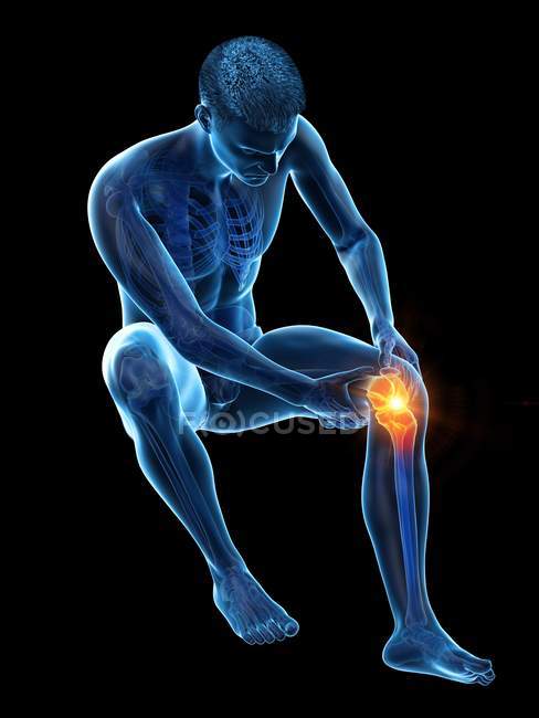 Silhouette d'un homme assis souffrant de douleurs au genou, illustration conceptuelle . — Photo de stock