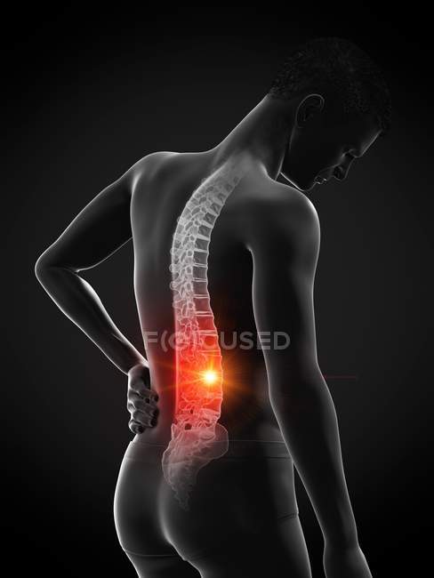 Silueta masculina con dolor de espalda sobre fondo negro, ilustración conceptual . - foto de stock