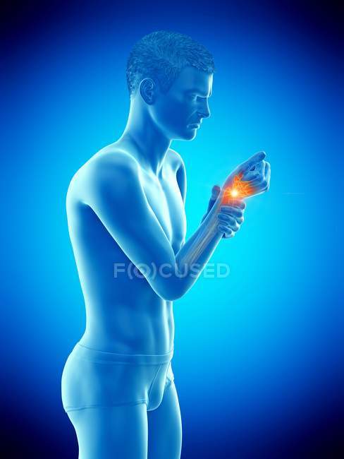 Abstract man body with wrist pain, conceptual illustration. — Stock Photo