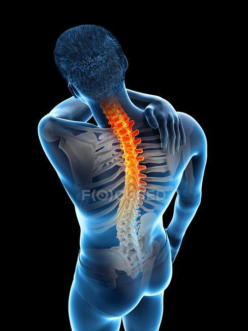Male silhouette with hand on inflammation of back pain, conceptual illustration. — Stock Photo