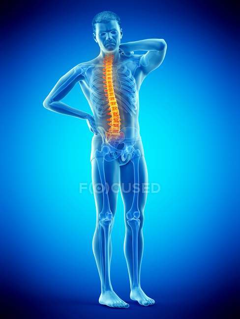 Männlicher Körper mit Rückenschmerzen auf blauem Hintergrund, konzeptionelle Illustration. — Stockfoto