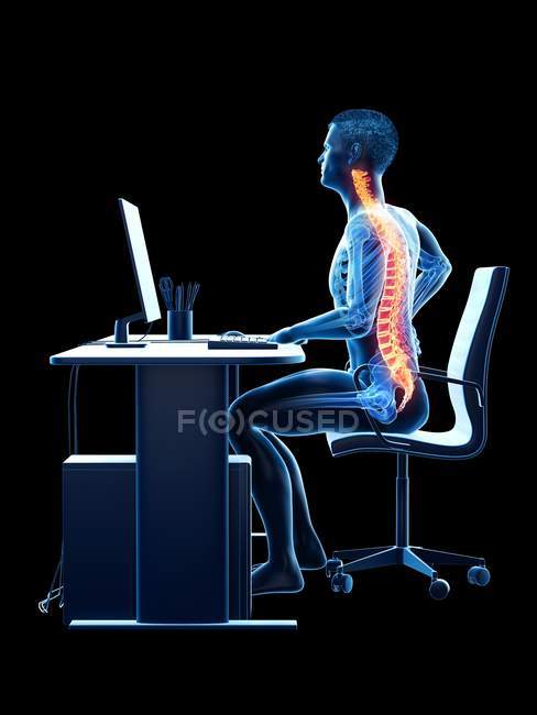 Male office worker with back pain, conceptual illustration. — Stock Photo