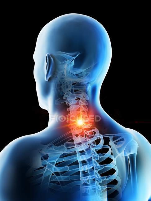 Абстрактное мужское тело с подробной болью в шее, концептуальная цифровая иллюстрация . — стоковое фото